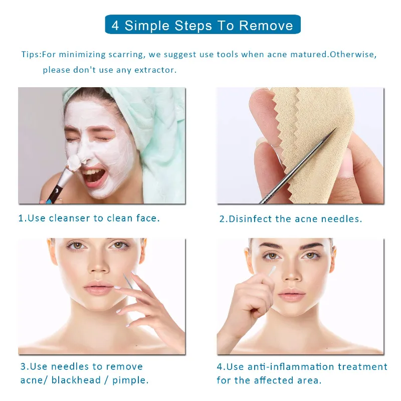 5 Piece Blackhead Remover Extractor Tool Kit