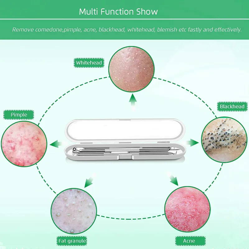 5 Piece Blackhead Remover Extractor Tool Kit