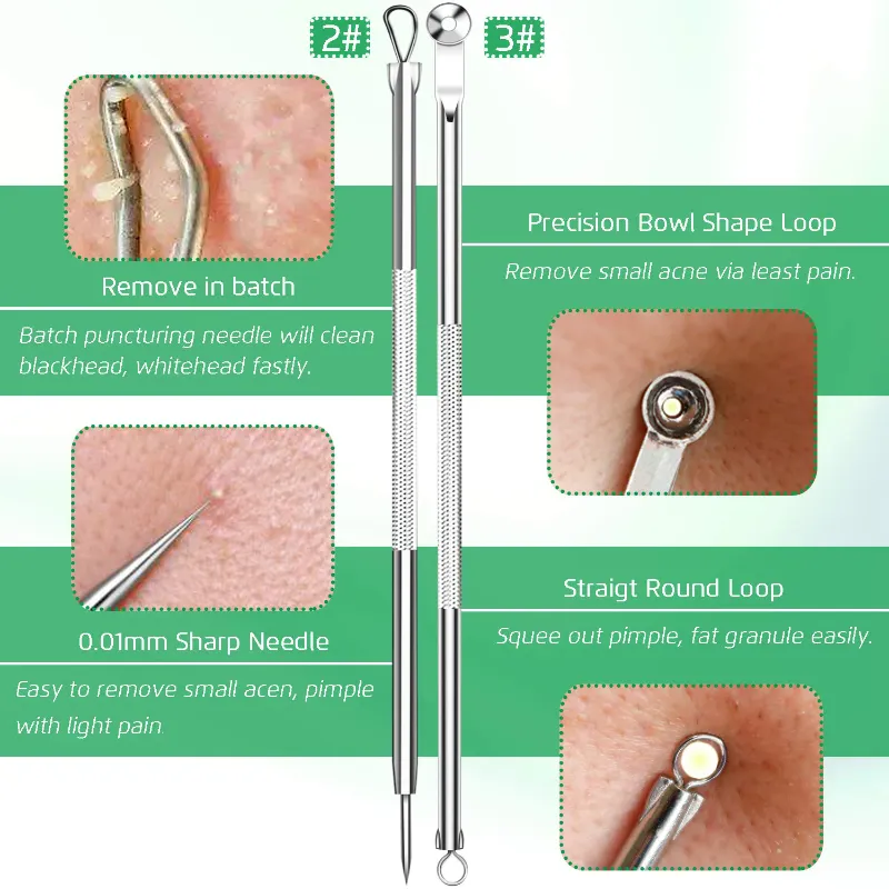 5 Piece Blackhead Remover Extractor Tool Kit